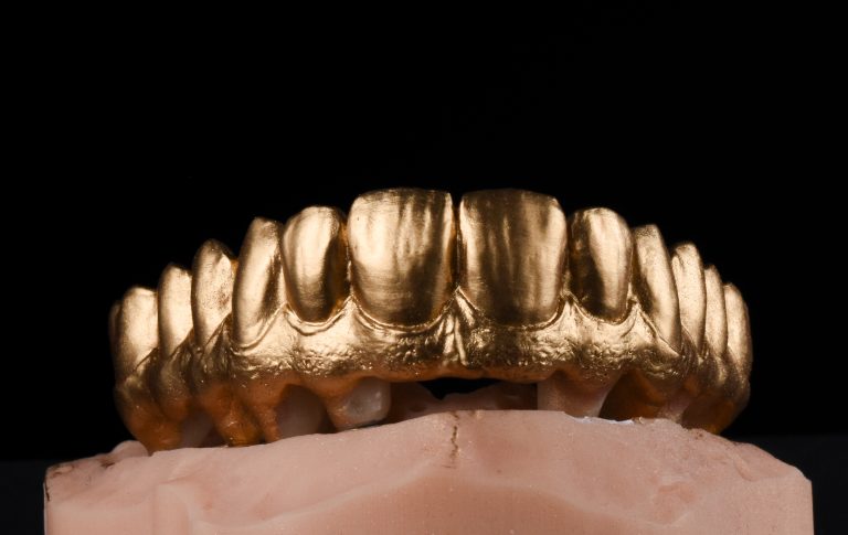 Zahn Implantat - Dentallabor Nürnberg - Zahnlabor Nürnberg - Dentalmanufaktur