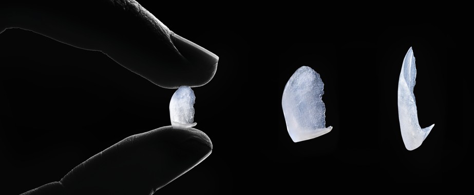 Non Prep Veneers - Herstellung - Zahnlabor Nürnberg