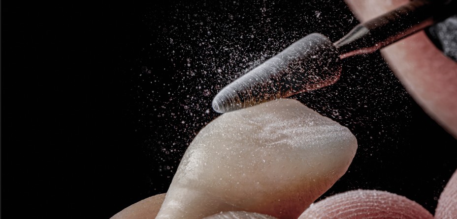 Zahnersatz - Herstellung - Dentallabor - Zahnlabor - Nünberg