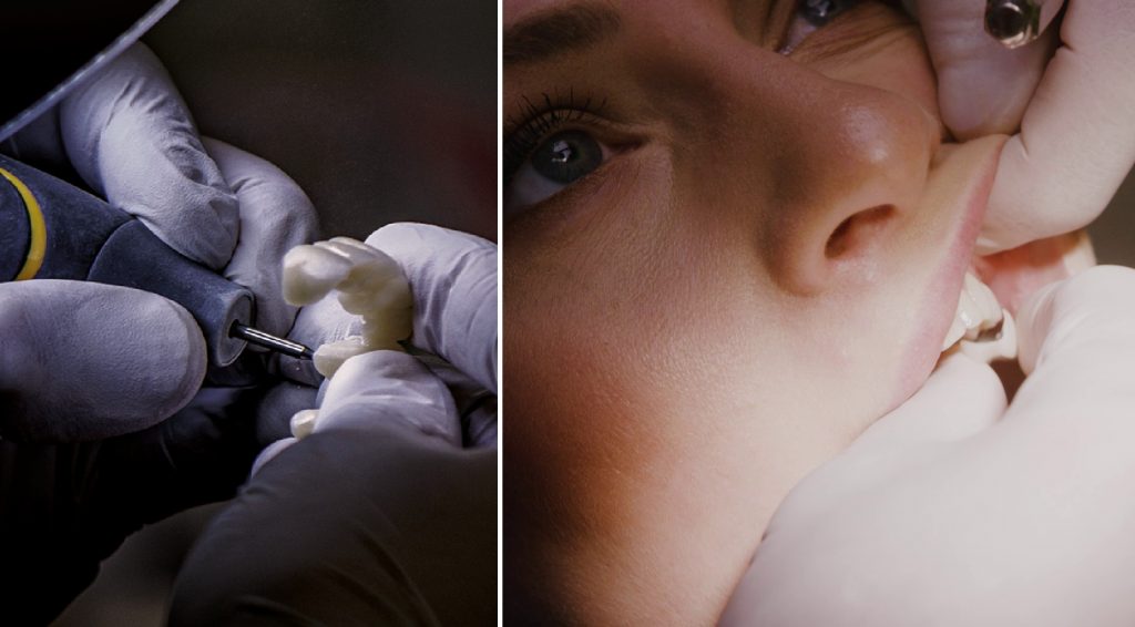 Zahnlabor München - Zahntechnik München - Feritgung Provisorium Zahnlabor München - Zahntechnik München - Feritgung Provisorium